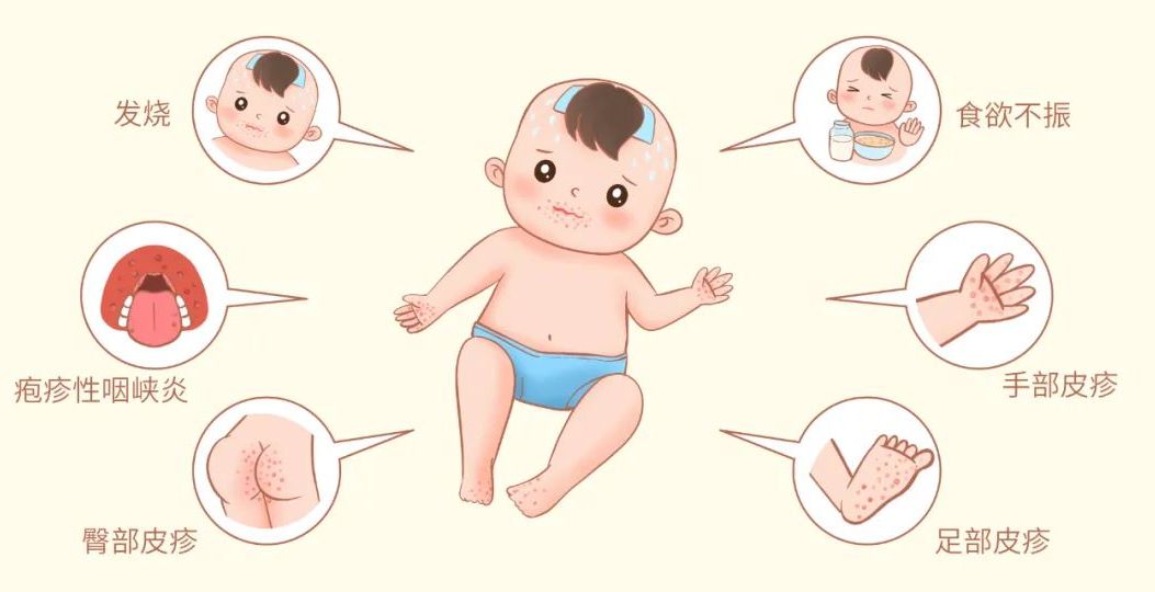 预防手足口病，从讲究卫生开始！